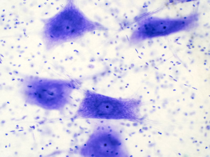 Neurons cells from the brain under the microscope