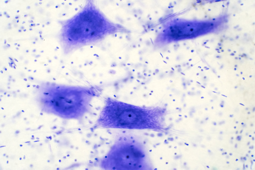 Neurons cells from the brain under the microscope