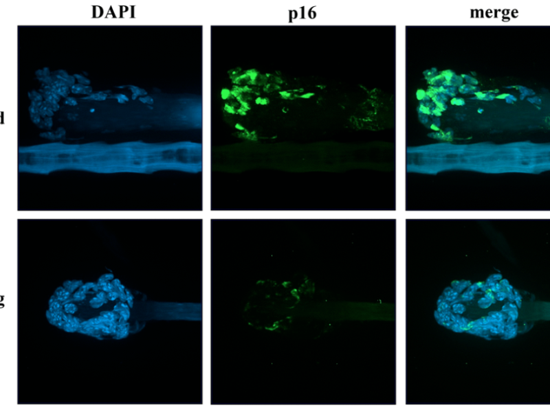 Figure 6. Markers of senescence analysis in hair follicular cells.