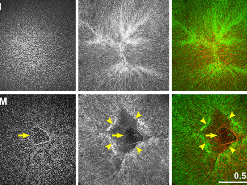 (Truncated) Figure 7. Whole lens staining for F-actin (phalloidin, green) and nuclei (DAPI, red) in 4-month-old and 18-month-old lenses.