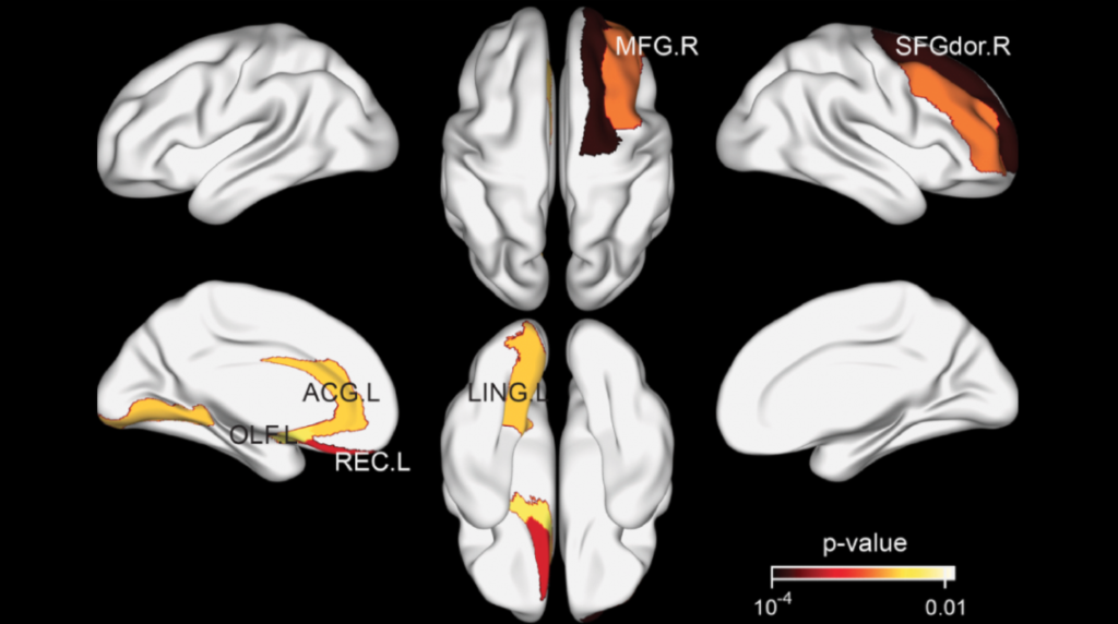 How Habitual Tea Drinking Impacts Brain Structure
