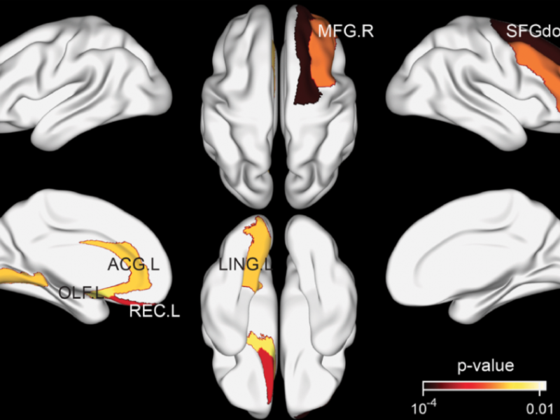 How Habitual Tea Drinking Impacts Brain Structure