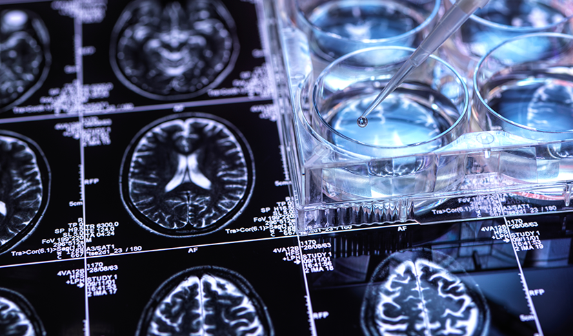 Cognitive decline