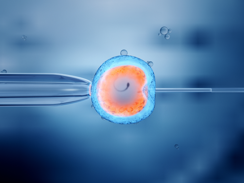 IVF