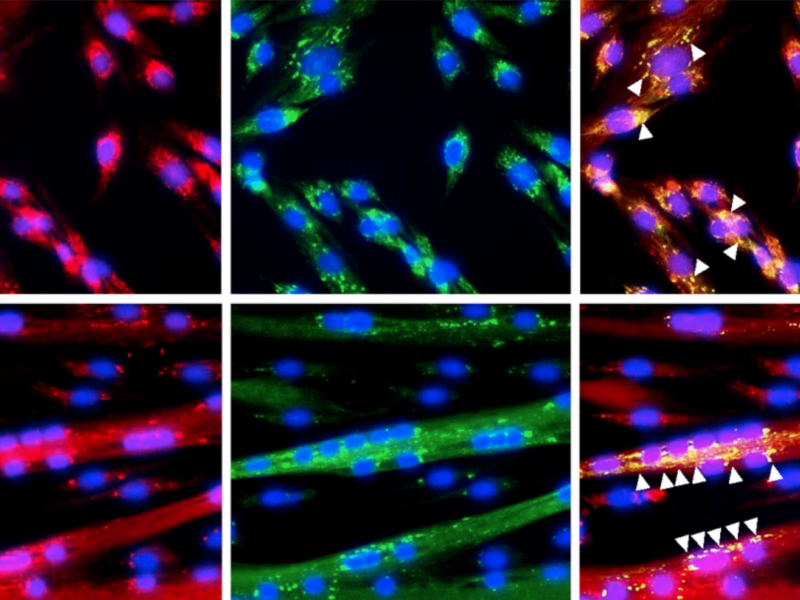 Immunofluorescence detection of GRSF1 (green) and mitochondria (red) in proliferating myoblasts and differentiating myotubes. Arrowheads indicate GRSF1 signals; n=3. Scale bar, 50 μm.