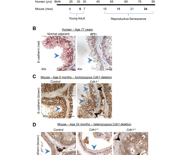 Figure 1. Modeling the combined impact of heterozygous E-cadherin loss and aging on the murine prostate.