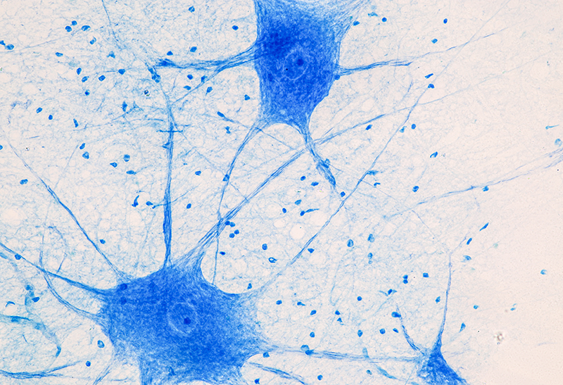 The Role of R-loops in Neuronal Aging