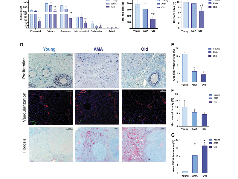 Deciphering reproductive aging in women using a NOD/SCID mouse model for distinct physiological ovarian phenotypes