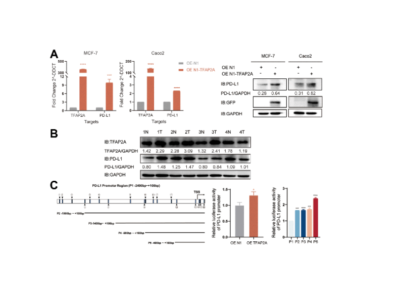 Potential prognosis and immunotherapy predictor TFAP2A in pan-cancer