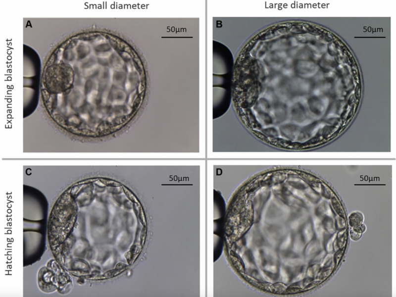 Reproductive aging, preimplantation genetic testing for aneuploidy, and the diameter of blastocysts: does size matter?