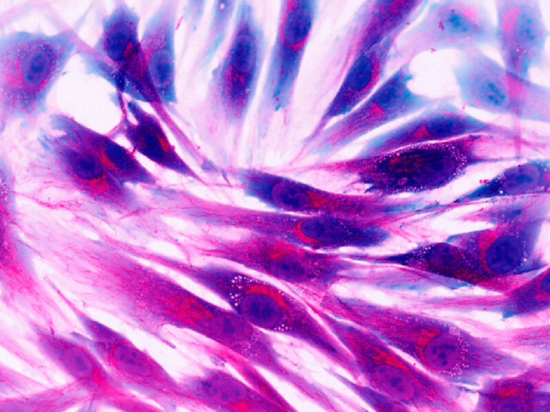 Real fluorescence microscopic view of human skin cells